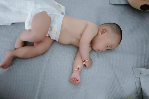 东营宝宝头上长痱子